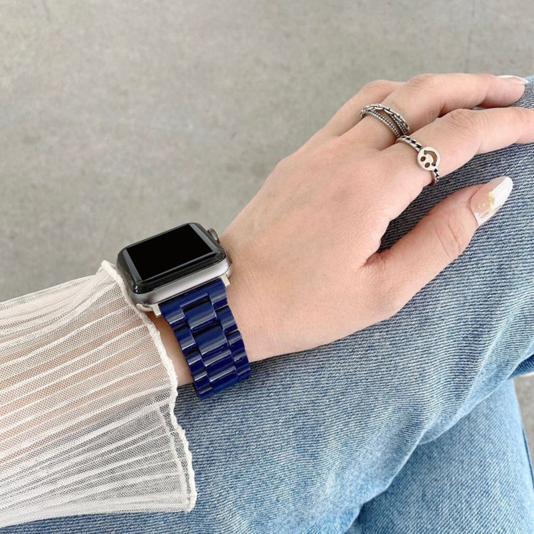 Candy Color Three-Bead Watchband For Apple Watch Series, 7 41mm / 6&SE&5&4 40mm / 3&2&1 38mm, 7 45mm / 6&SE&5&4 44mm / 3&2&1 42mm