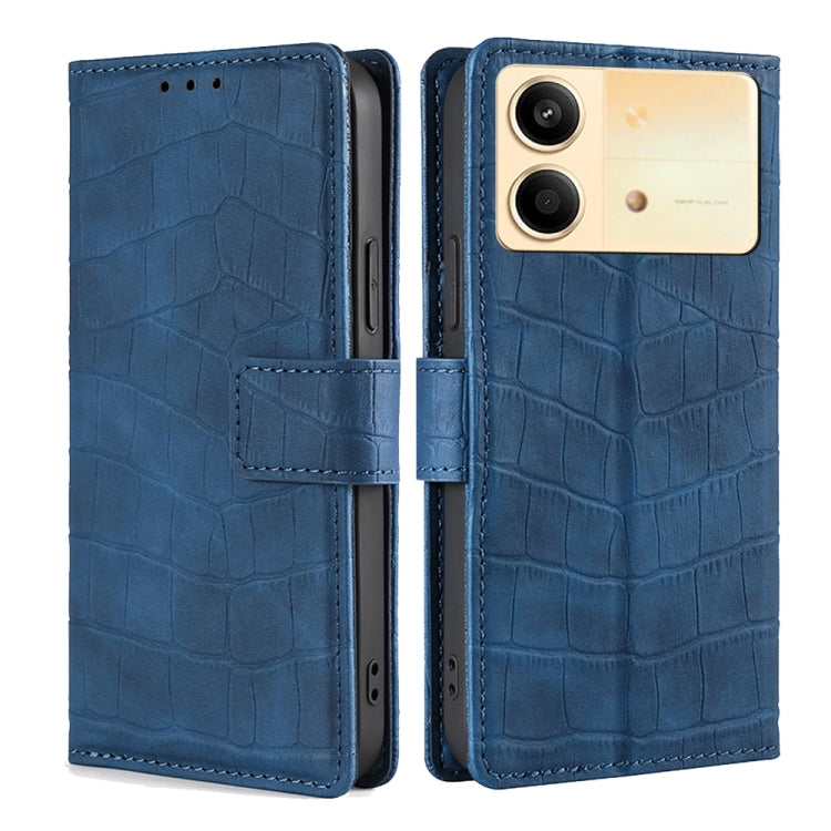 Skin Feel Crocodile Magnetic Clasp Leather Phone Case