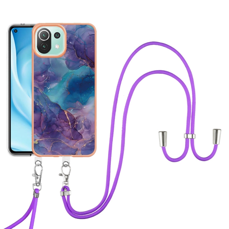 Electroplating Marble Dual-side IMD Phone Case with Lanyard