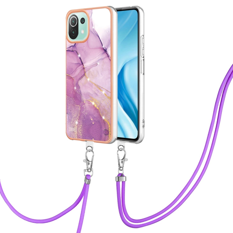 Electroplating Marble Dual-side IMD Phone Case with Lanyard