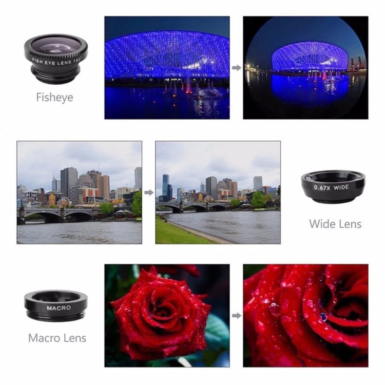 3 in 1 Smartphone Camera Lens Set Fisheye Telephoto Macro for iPhone Galaxy